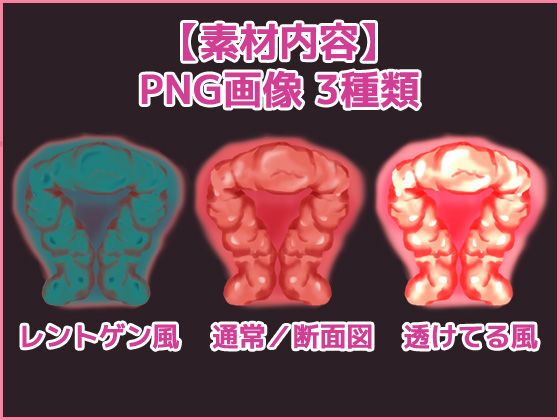 Uterus (Cross-Section) Illustration - Royalty-Free Adult Commercial Use OK